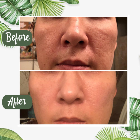 Natural Green Tea Clay Mask Stick– Clears Acne & Refines Pores🌿