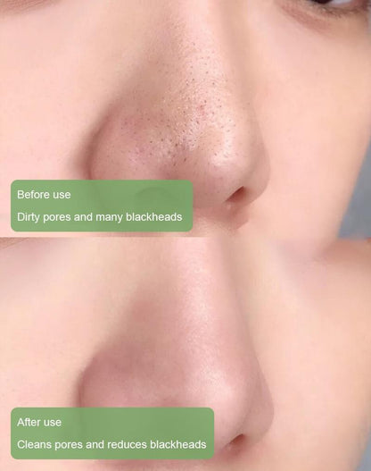 Natural Green Tea Clay Mask Stick– Clears Acne & Refines Pores🌿