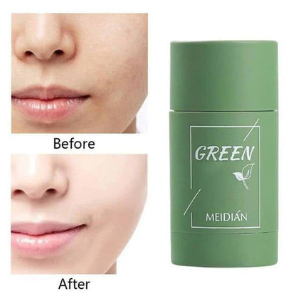 Natural Green Tea Clay Mask Stick– Clears Acne & Refines Pores🌿